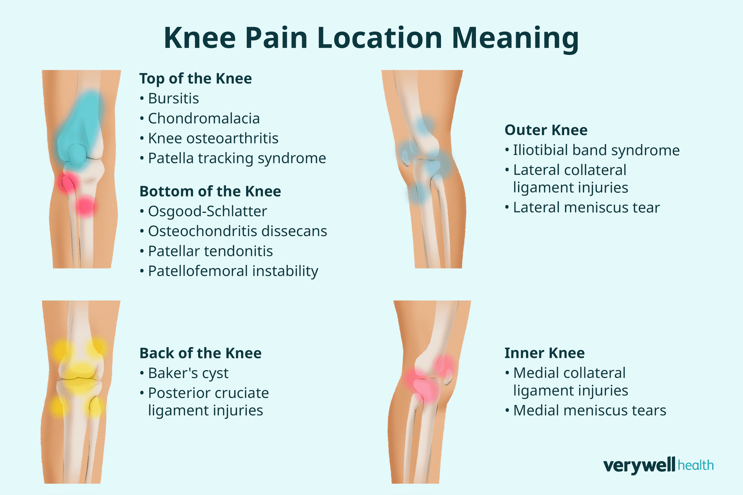 Knee Pain