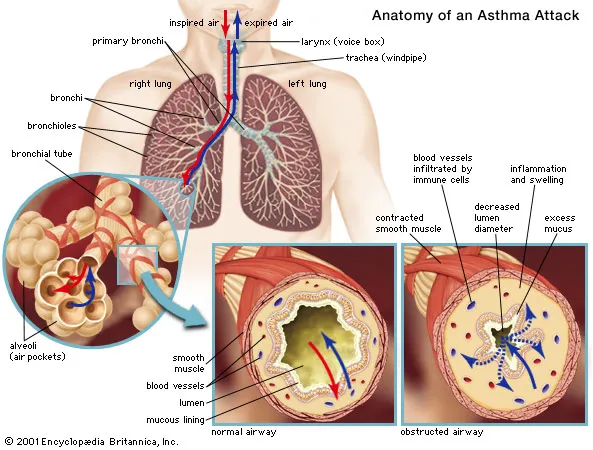 Respiratory Diseases