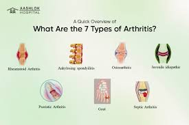 Arthritis